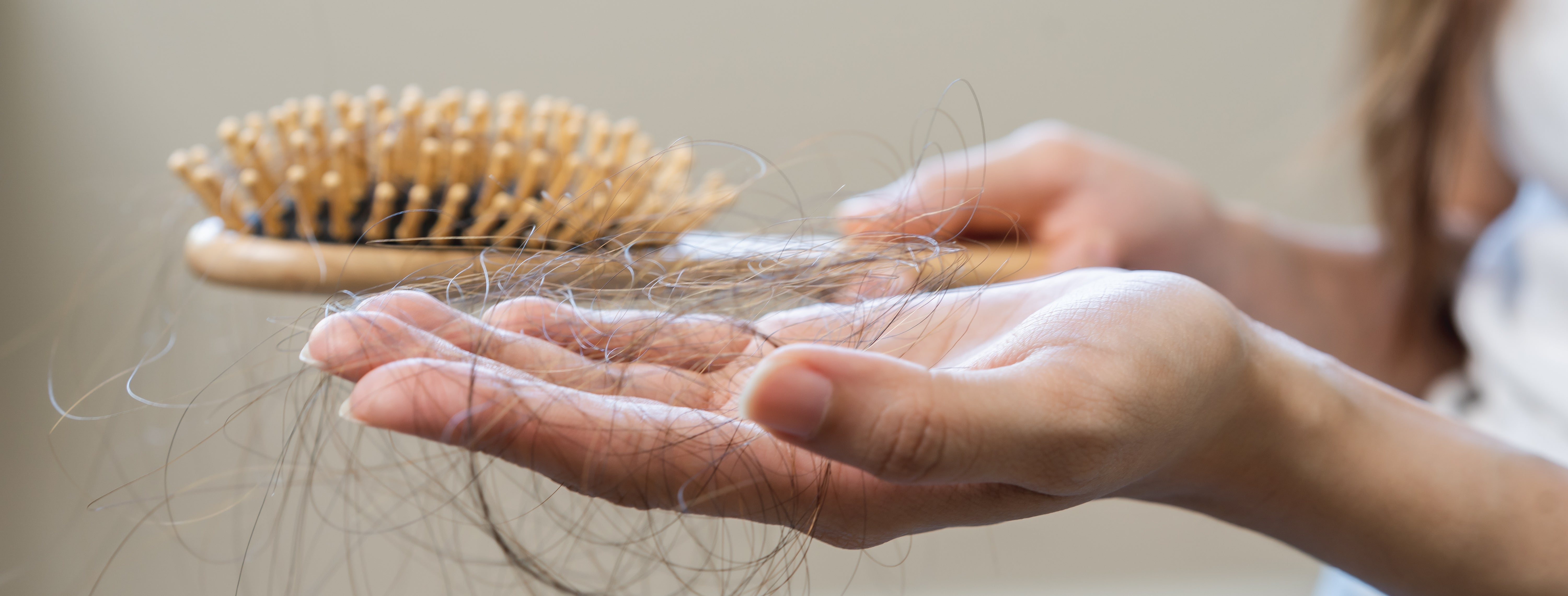 How Much Hair Loss Is Normal Identifying Your Hairs Health