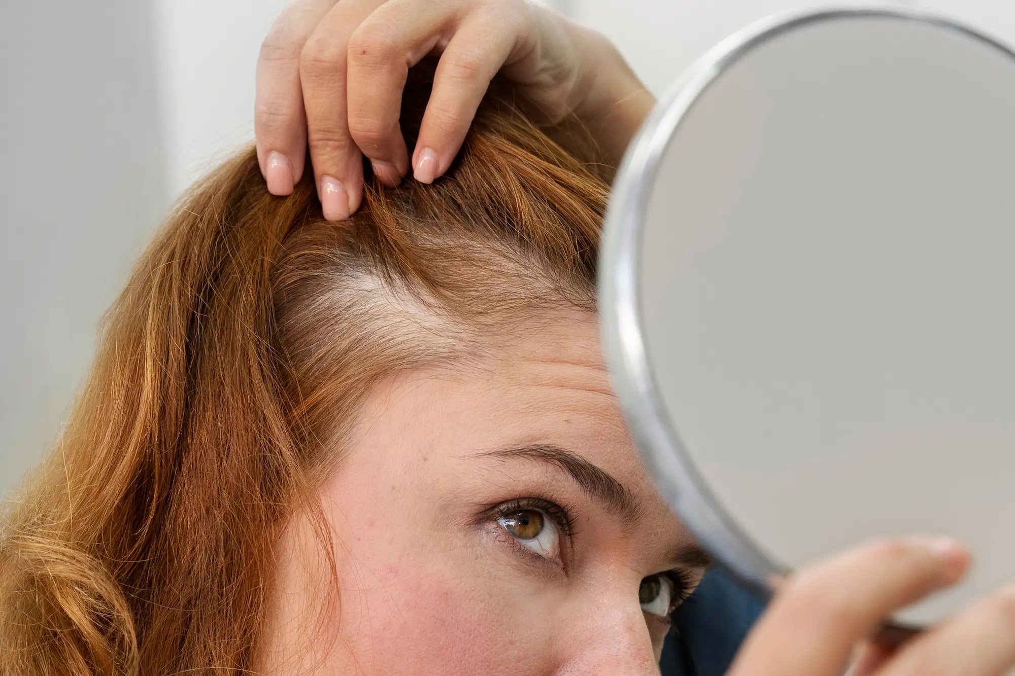 are baby hairs a sign of balding or regrowth