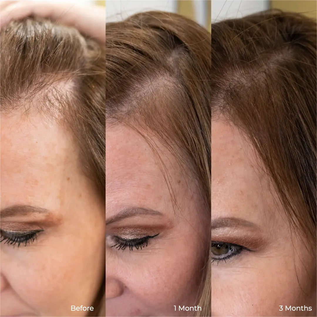 glutathione california Glutathione for Skin: Benefits, Results, Side Effects & Myths (2025 Guide)