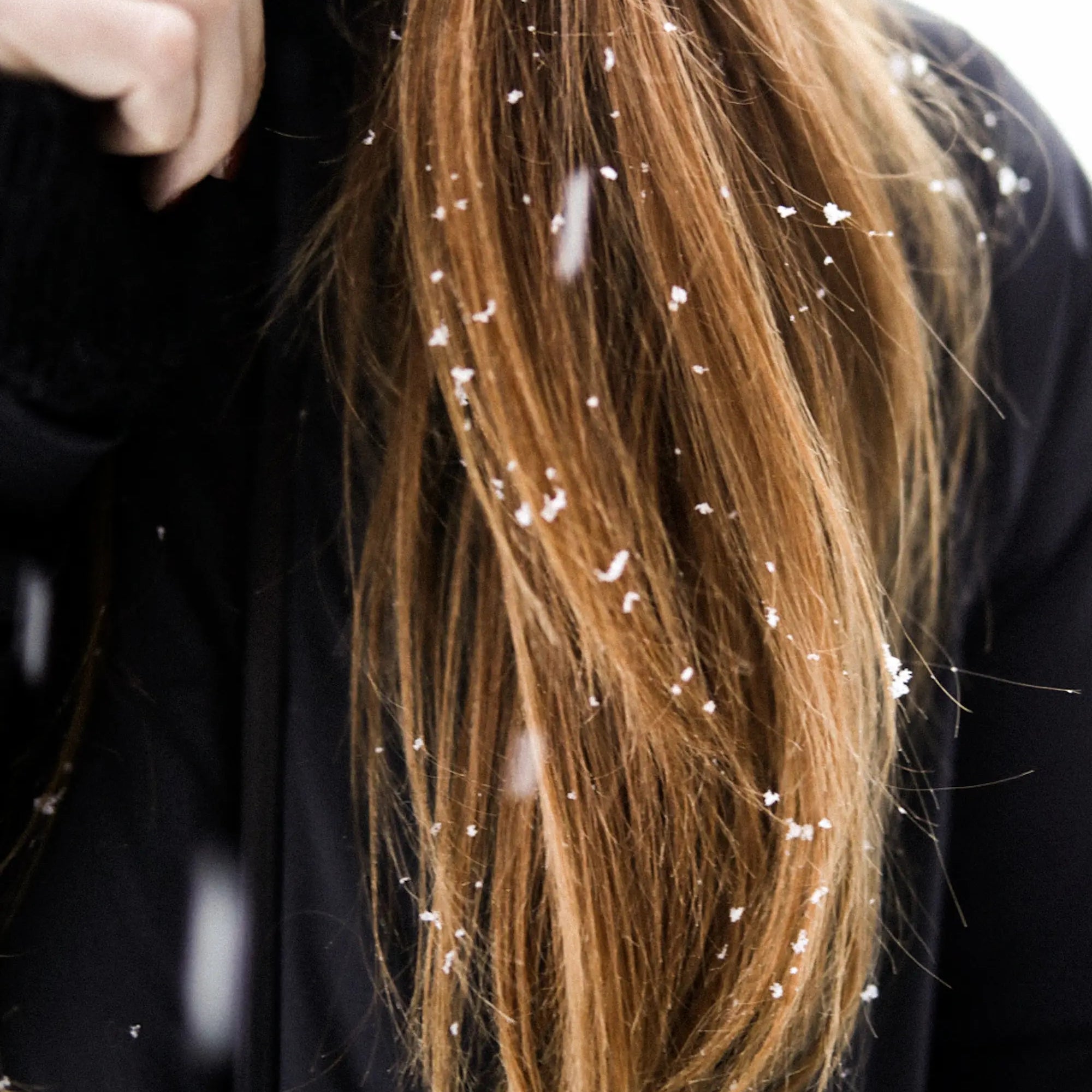 Conquer Winter Hair Woes: Ultimate Guide to Healthy, Hydrated Locks