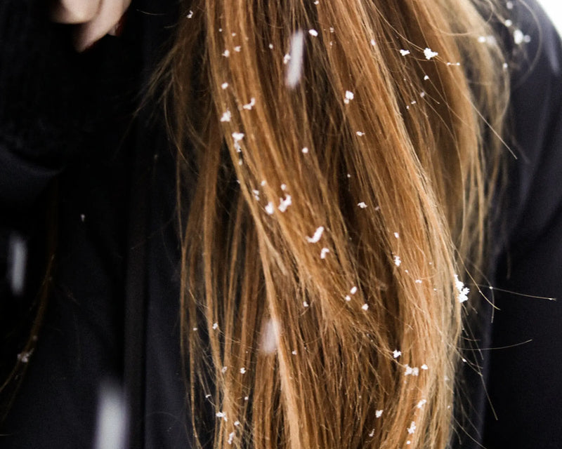 Conquer Winter Hair Woes: Ultimate Guide to Healthy, Hydrated Locks