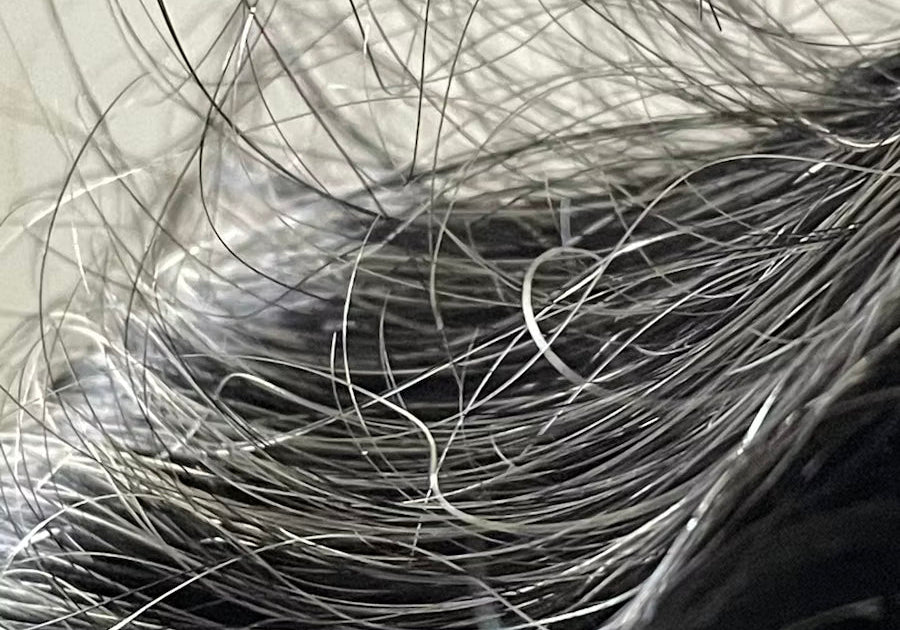 Summer Body Goals, But Your Hair Is Not Keeping Up? Here’s What Might Be Happening