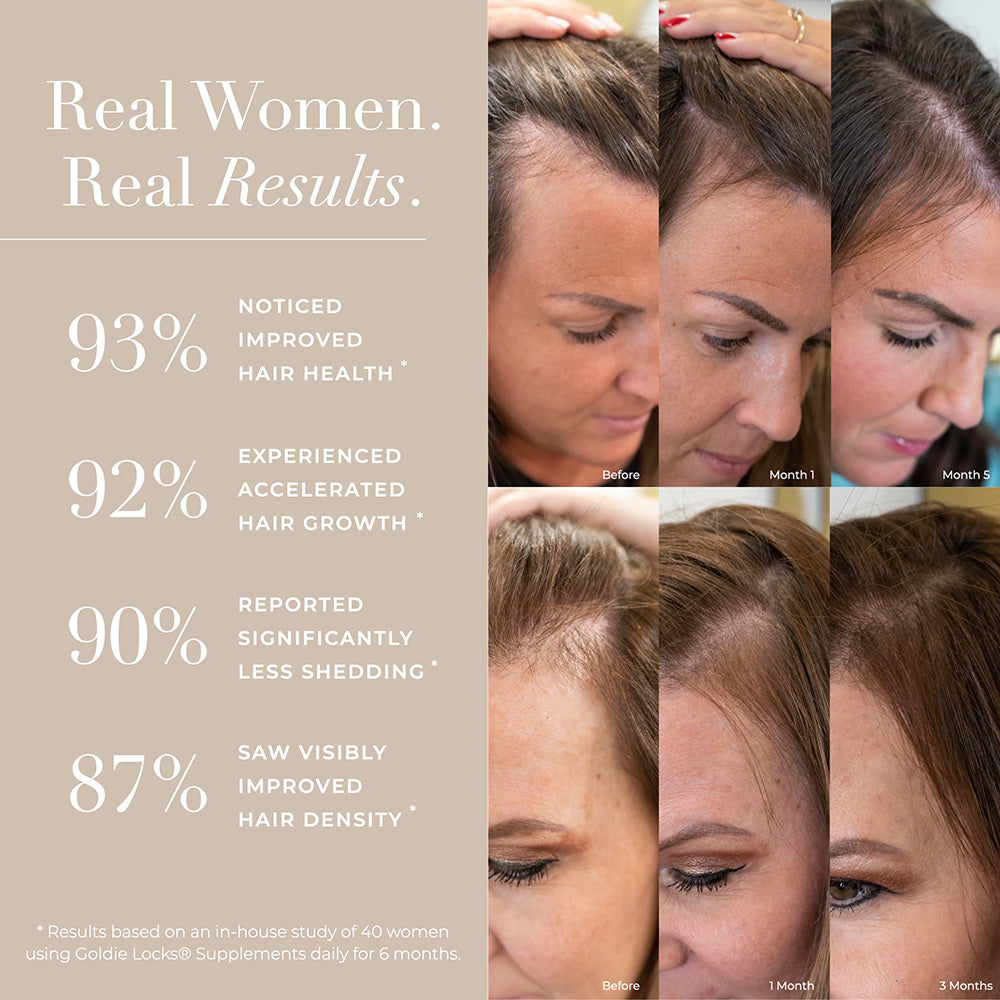 hair growth supplements results